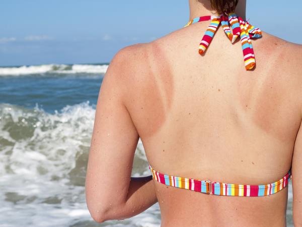 Znate izbrati pravo zaščito pred soncem?